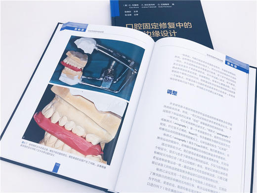 口腔固定修复中的垂直边缘设计 布鲁纳 口腔科学矫形外科学天然牙预备临时修复体制备技工咬合重建支架与底冠修复体黏固种植体基台 商品图3