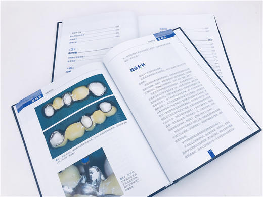 口腔固定修复中的垂直边缘设计 布鲁纳 口腔科学矫形外科学天然牙预备临时修复体制备技工咬合重建支架与底冠修复体黏固种植体基台 商品图4