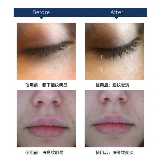 二代澳洲Cemoy飞碟眼霜20ml 商品图5