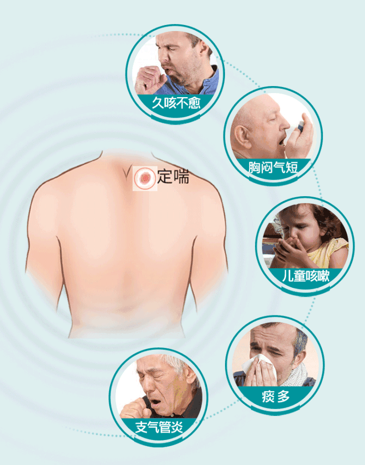 芙顺堂穴位磁疗贴专贴咳痰喘穴位磁疗内病外治适用于急慢性支气管炎