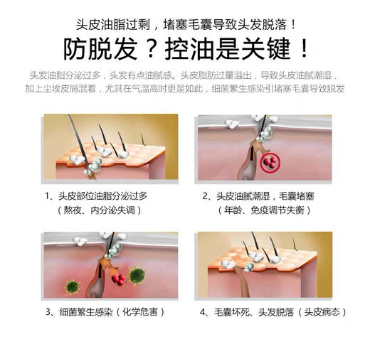 泰国Atreus生姜洗发水400ml 商品图6