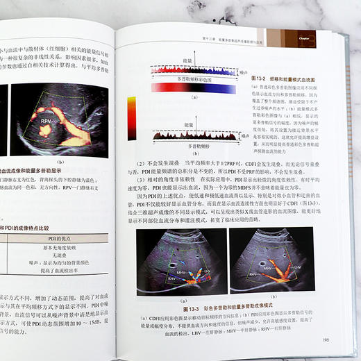 临床常见疾病超声图谱系列 超声诊断基础与临床应用图解 任卫东 常见疾病超声诊断方法常用超声诊断技术原理应用医学书 图文并茂 商品图4