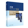 肿瘤PET/CT图谱——神经和头颈部肿瘤卷 商品缩略图0