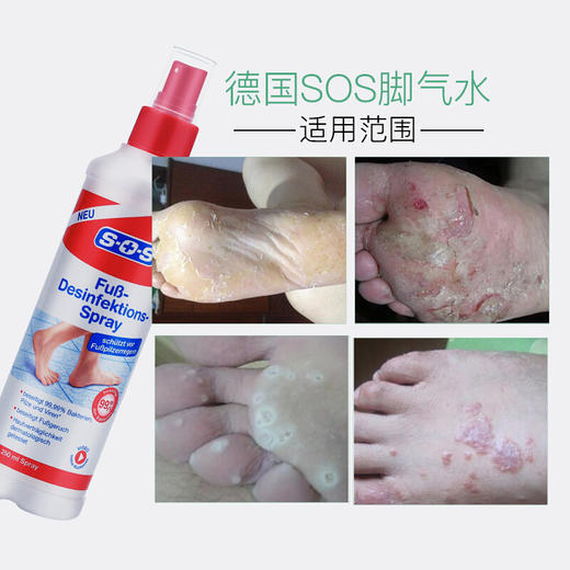 【李佳琦推荐，德国SOS足部喷雾】除脚臭鞋袜除味剂250ml夏天足部抑菌除味喷雾鞋袜鞋柜除臭剂杀菌止痒去脚气去脚汗脚臭消毒抑菌止痒喷雾 商品图3