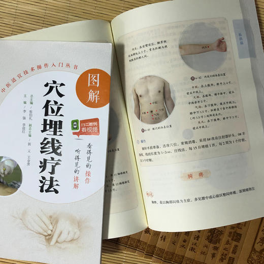 图解穴位埋线疗法（分类：书籍） 商品图1