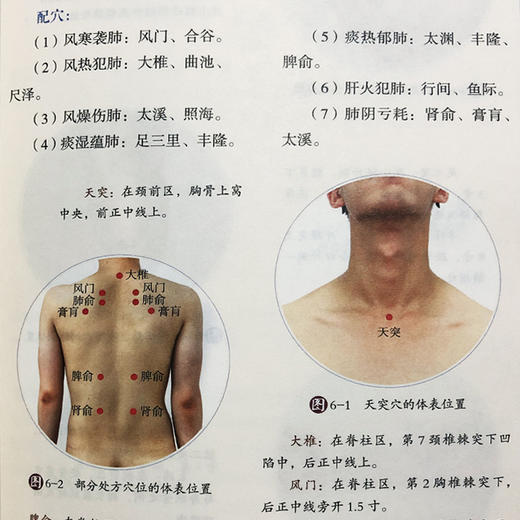 图解穴位埋线疗法（分类：书籍） 商品图5