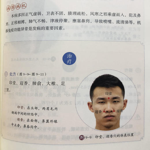 图解穴位埋线疗法（分类：书籍） 商品图4