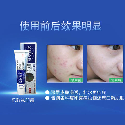 【买一送一】香港乐敦祛痘祛印霜（备注送的款式） 商品图4
