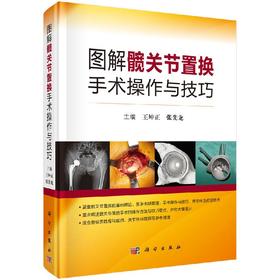 图解髋关节置换手术操作与技巧/王坤正 张先龙