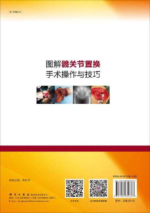 图解髋关节置换手术操作与技巧/王坤正 张先龙 商品图1