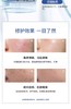 海本修护冻干粉拍3发4盒 双十一活动 5万单位修复屏障红血丝痘痘 商品缩略图4