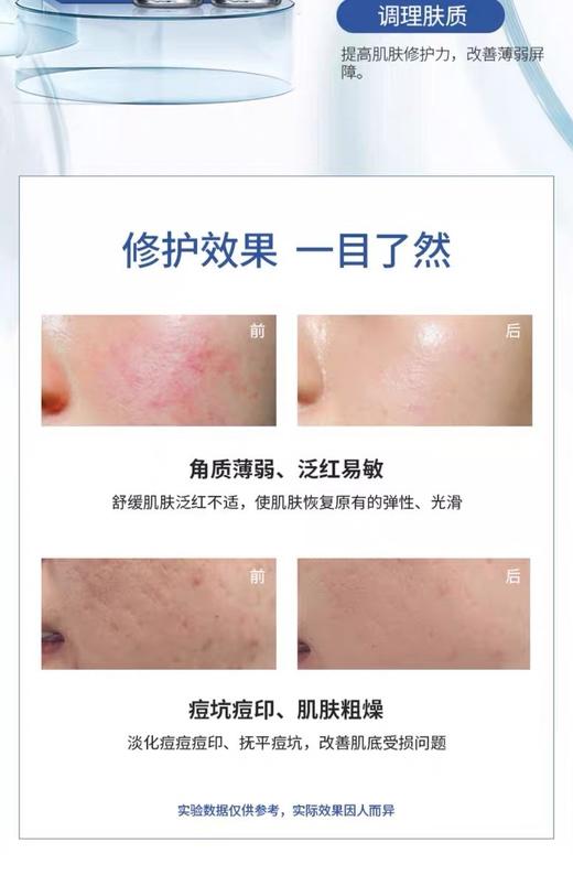 海本修护冻干粉拍3发4盒 双十一活动 5万单位修复屏障红血丝痘痘 商品图4