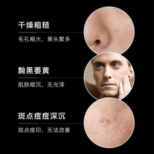 洗面奶男士专用套装组合装控油去黑头祛痘印美白护肤品补水除螨虫