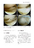 75折包邮《半月板手术学》 商品缩略图1