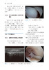 75折包邮《半月板手术学》 商品缩略图4