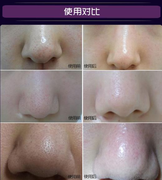 Ciracle稀拉克儿 去黑头鼻贴10片 导出液祛白头 黑头 收毛孔鼻膜 商品图5