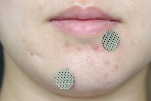 芙芙祛痘贴夜用36枚（老款停产） 商品图6