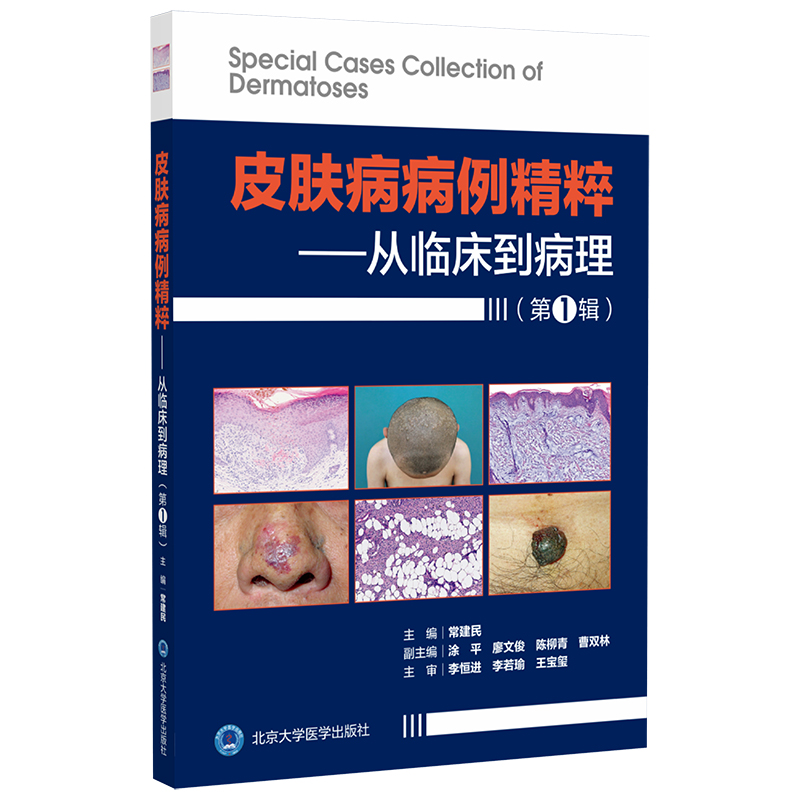 皮肤病病例精粹——从临床到病理(第1辑)  主编：常建民