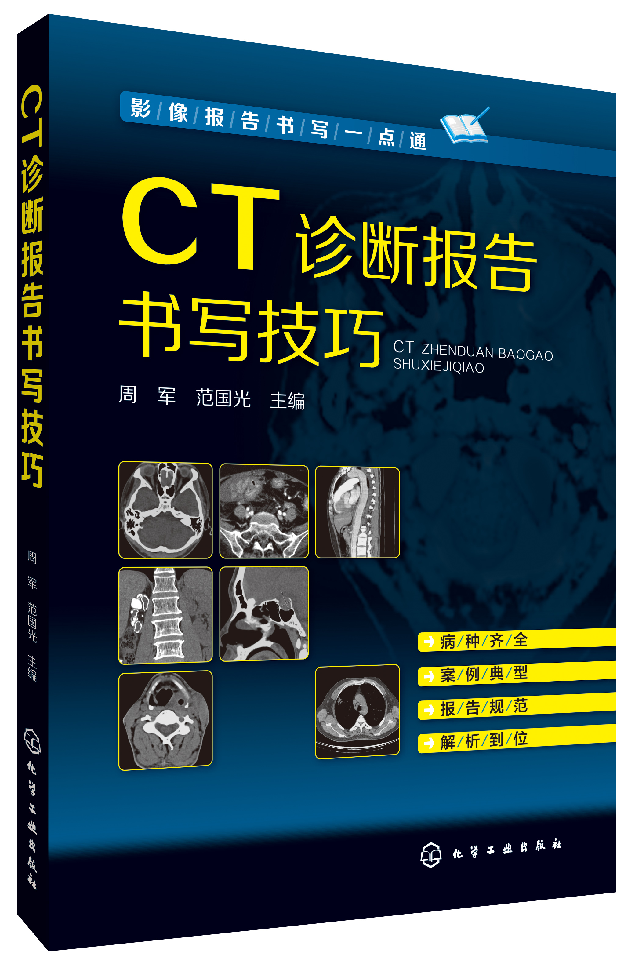 影像报告书写一点通  CT诊断报告书写技巧   CT图谱大全 医学影像报告书写一点通 看片读片指南 新手学拍片教程 医学 医学影像