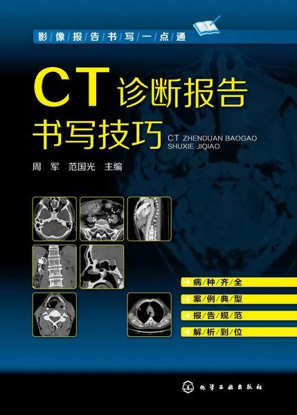 影像报告书写一点通  CT诊断报告书写技巧   CT图谱大全 医学影像报告书写一点通 看片读片指南 新手学拍片教程 医学 医学影像 商品图1