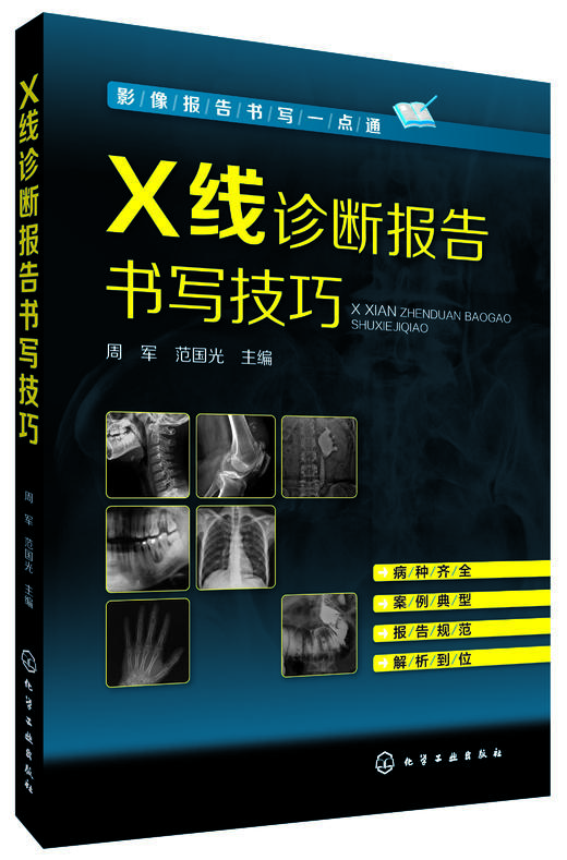 影像报告书写一点通 X线诊断报告书写技巧  X线读片指南图谱 X线诊断入门与提高 实用介入放射学手册 化工出版社 商品图1