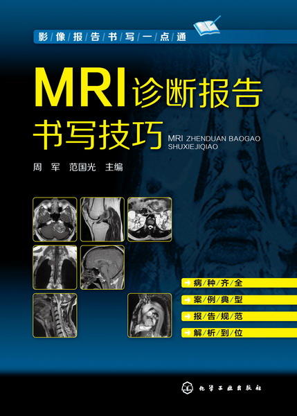 MRI诊断报告书写技巧  影像报告书写一点通系列作者：范国光化学工业出版社 商品图1