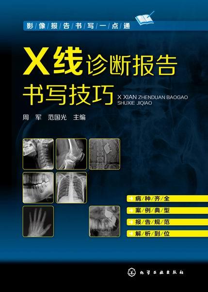 影像报告书写一点通 X线诊断报告书写技巧  X线读片指南图谱 X线诊断入门与提高 实用介入放射学手册 化工出版社 商品图2