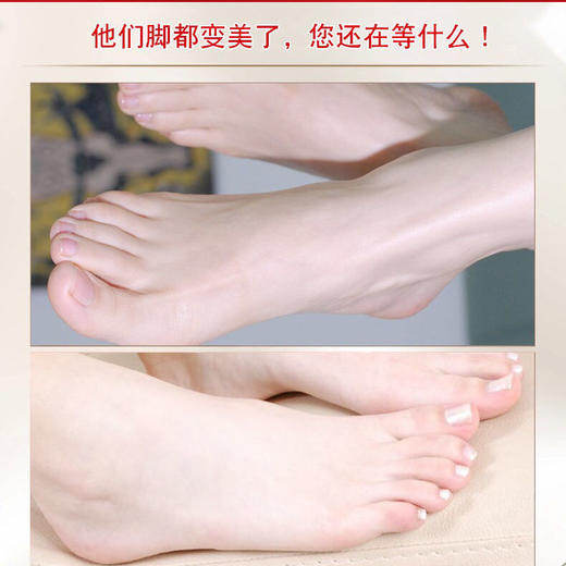 【买2送1 】脚qi偏方yi菌乳膏 15克/盒 商品图1