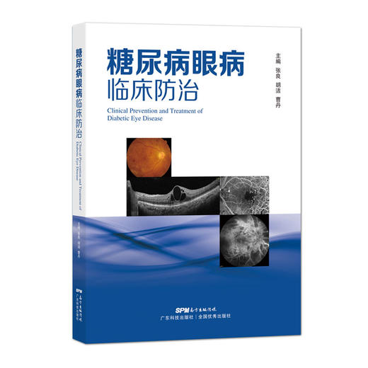 糖尿病眼病临床防护 商品图0