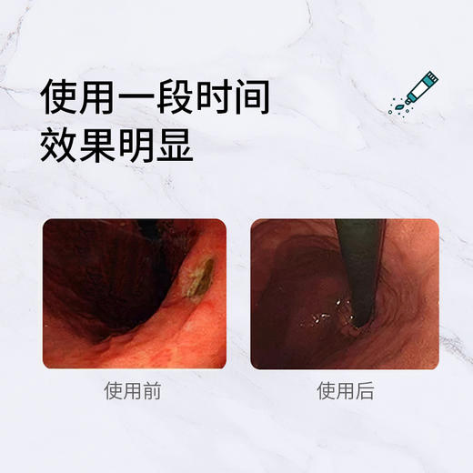 【买2送1 】消字号认证济利康牙膏100g每支 商品图5