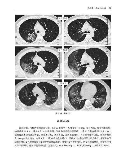 肺部疑难疾病多学科会诊 路希维 李海潮 北医社 商品图5