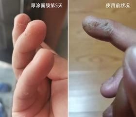 童话面膜用户口碑反馈