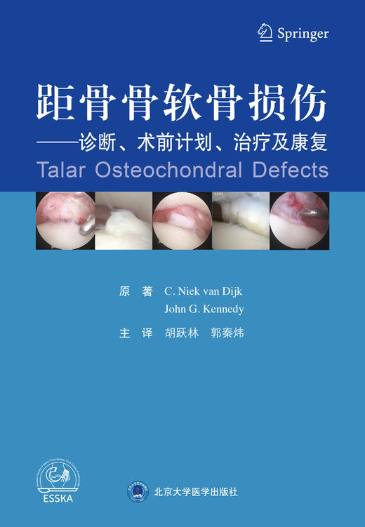 距骨骨软骨损伤（诊断、术前计划、治疗及康复）主    译：胡跃林 郭秦炜    北医出版 商品图1