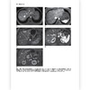 腹部盆腔MRI（第4版）彩色插图临床医生实习护士影像 护理院校学生学习医学专业参考书籍 商品缩略图2