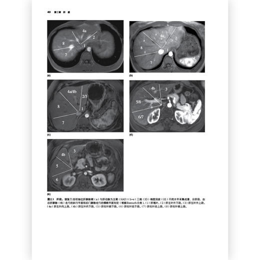 腹部盆腔MRI（第4版）彩色插图临床医生实习护士影像 护理院校学生学习医学专业参考书籍 商品图2