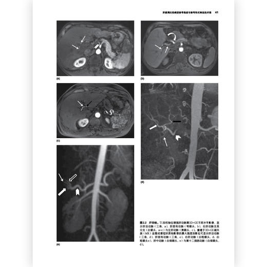 腹部盆腔MRI（第4版）彩色插图临床医生实习护士影像 护理院校学生学习医学专业参考书籍 商品图3