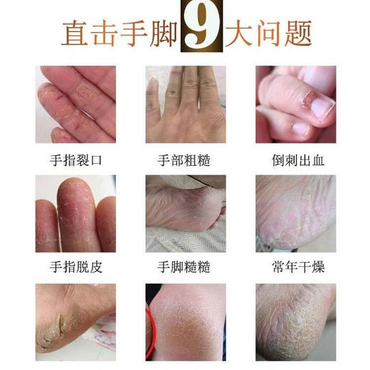 【每支80克】马油手裂脚裂膏脚后跟干燥开裂口护脚霜护手霜防裂膏 商品图1