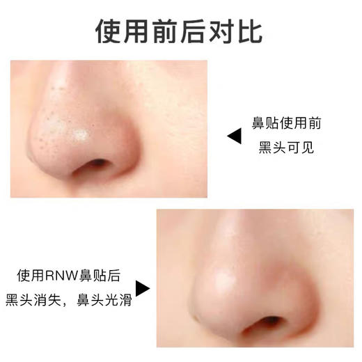 韩国RNW鼻膜贴 商品图5