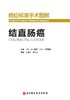 癌症标准手术图解——结直肠癌 商品缩略图1