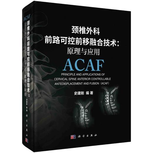 颈椎外科前路可控前移融合技术：原理与应用/史建刚 商品图0