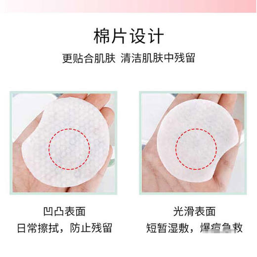 刷酸~美国stridex水杨酸棉片去闭口粉刺黑头二次清洁祛痘55片包邮JPY带授权招加盟代理 商品图2