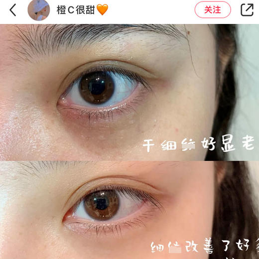 Olay A醇眼部护理霜~prox超A眼霜15g 抗皱紧致淡化细纹干纹包邮JPY带授权招加盟代理 商品图2