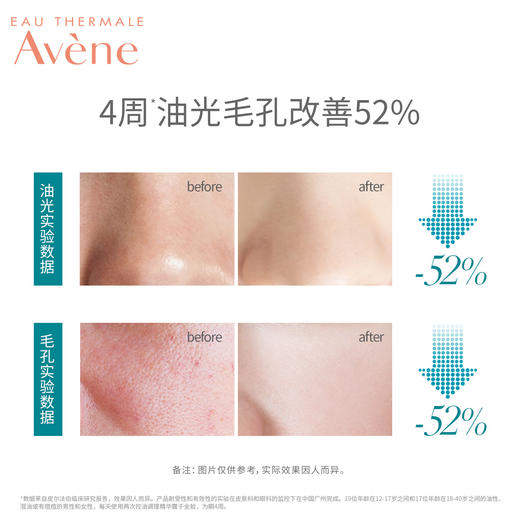 雅漾控油细致调理精华露30ml面部精华深层滋养温和补水保湿护肤JPY带授权招加盟代理 商品图2