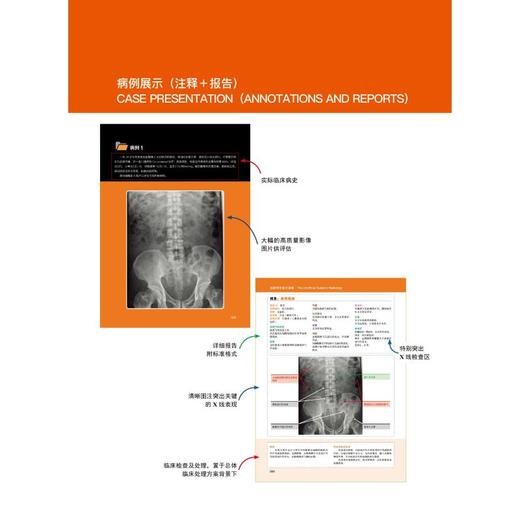 放射学非官方指南(100例腹部X线片实践全彩注释+完整报告)/国际经典影像学译著 商品图2