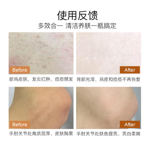 纽西之谜磨砂膏全身去角质鸡皮蜂蜜凝膏深层清洁ukiwi黑糖磨砂膏JPY带授权招加盟代理 商品图3