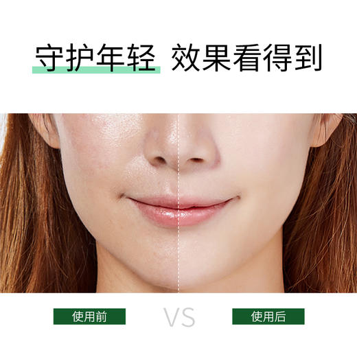 【临期秒杀】【效期至2026年4月】嘉媚乐绿魔瓶初抗赋活精华露30ml  面部抗皱补水  呵护平滑  初抗精华液 商品图3