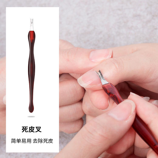 V型死皮叉 商品图1