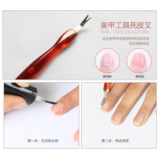 V型死皮叉 商品图2