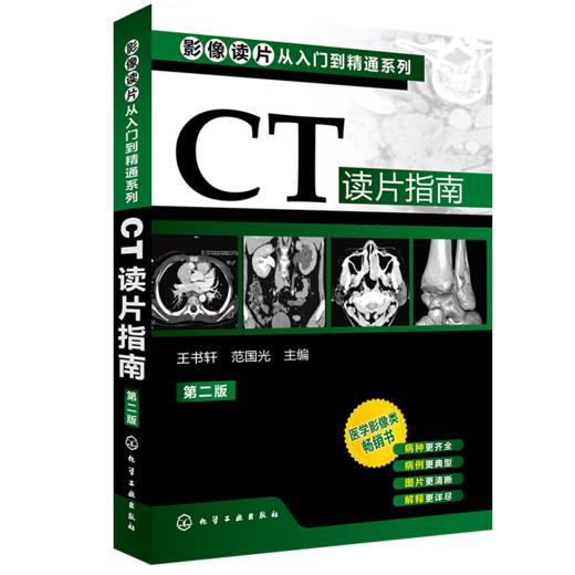 CT读片指南（第二版） 商品图0