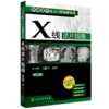 X线读片指南(第二版) 商品缩略图0